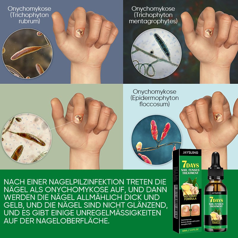 Ingwer-Nagelpflegelösung