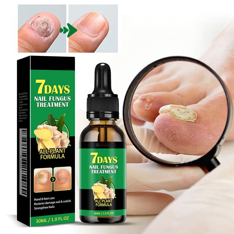 Ingwer-Nagelpflegelösung