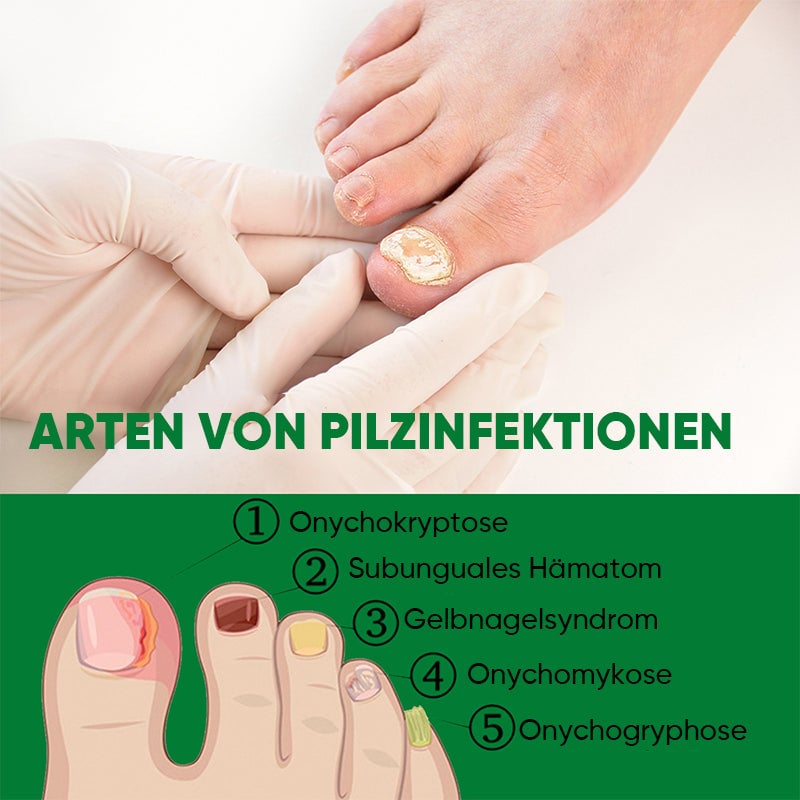 Ingwer-Nagelpflegelösung