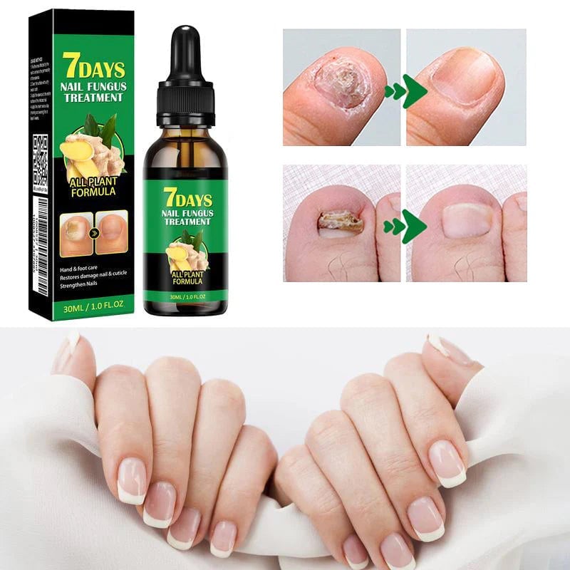 Ingwer-Nagelpflegelösung