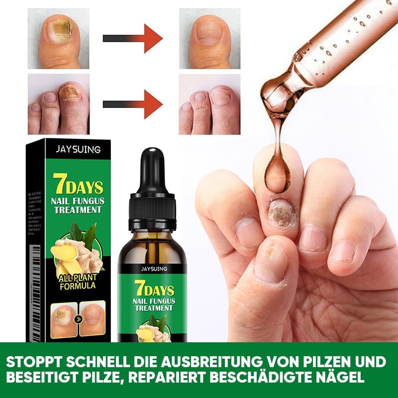 Ingwer-Nagelpflegelösung