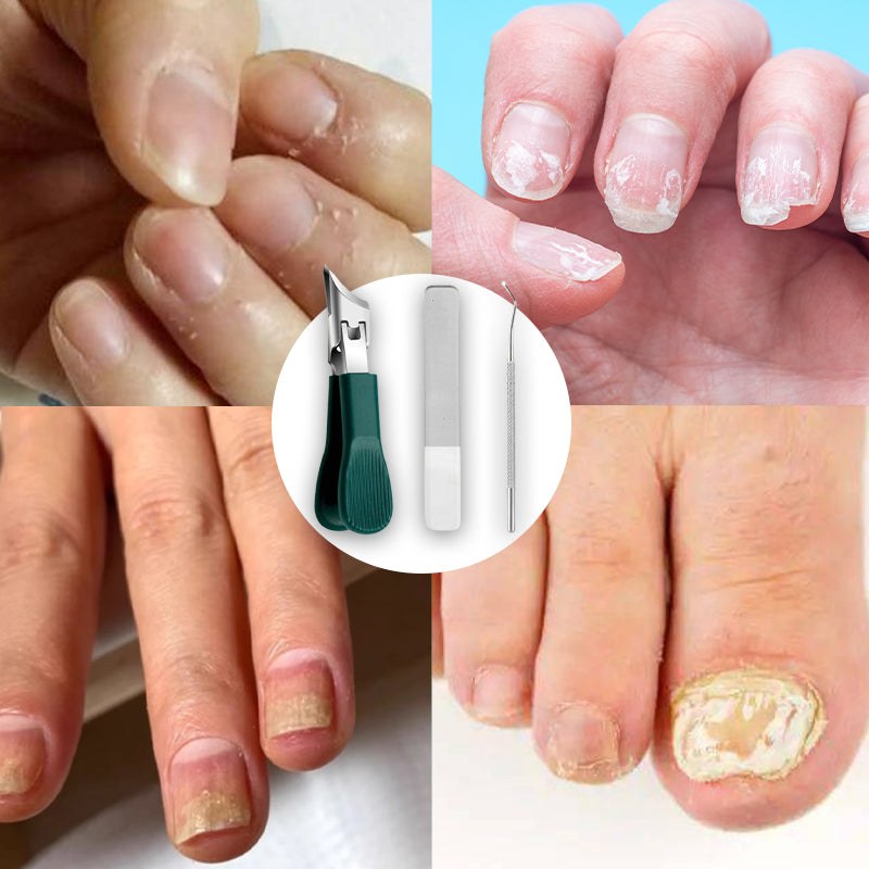 Drei Sets von Nagelknipsern mit Adlerkrallen und abgeschrägten Klingen