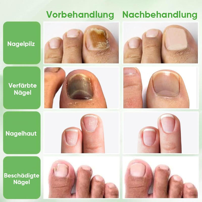 Ingwer-Nagelpflegelösung