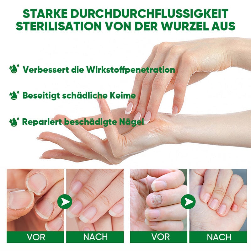 Ingwer-Nagelpflegelösung