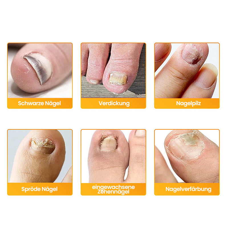 Pilz-Nagelpflaster